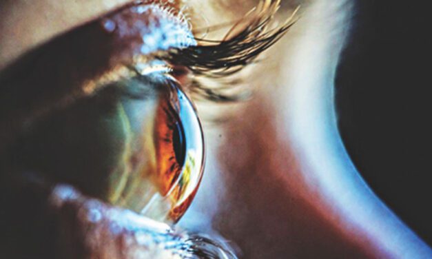 When your blurry vision is serious?