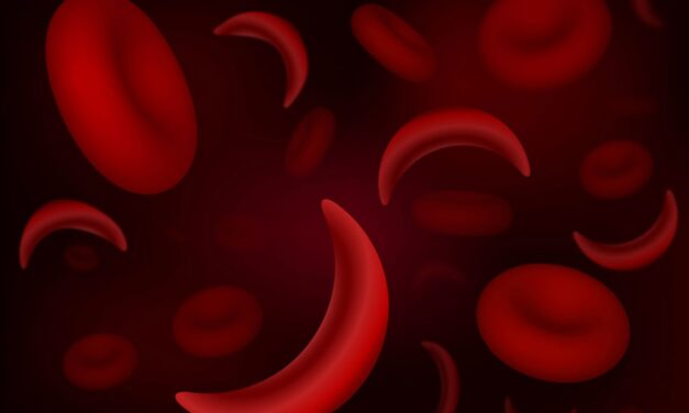 Sickle Cell Disease & Your Eyes
