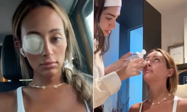 “Next Gen NYC ”Star Emira D’Spain Used Donated Body Tissue to Relieve Her Dry Eyes: ‘Craziest Treatment’