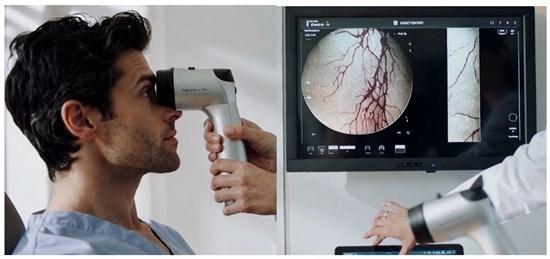 DiagnosTear Secures Exclusive Global Rights to CLARIFY Eye Imaging Platform for Needle-Free Blood Diagnostics