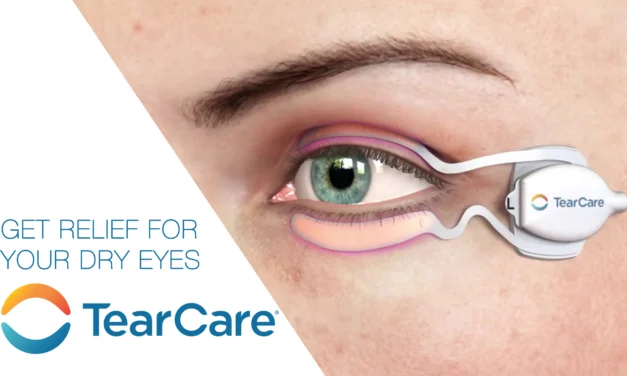 TearCare Becomes the First and Only MGD Treatment Indicated to Improve Meibomian Gland Function in Patients with Evaporative Dry Eye Disease