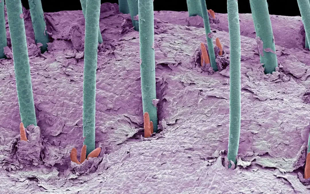 Parasite Infestation Common in Eyelash Extensions, Study Suggests