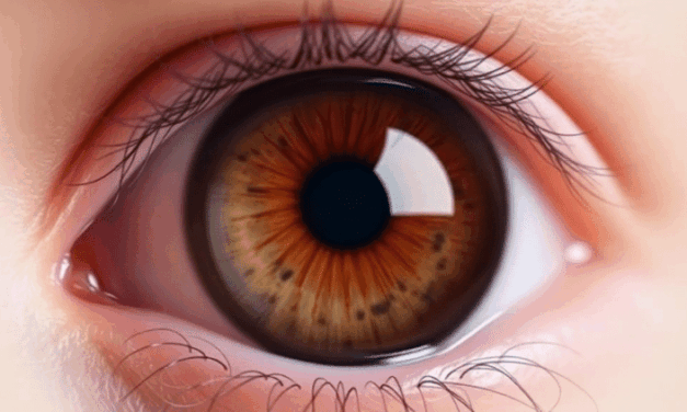 Tiny Eye Implant Slashes Glaucoma Drops by Half in Real-World Study
