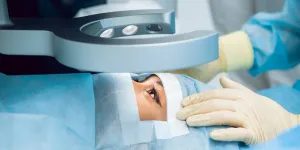 Laser Touch-Up Sharpens Vision for Patients Disappointed by Vision Quality After Cataract Surgery, Study Finds