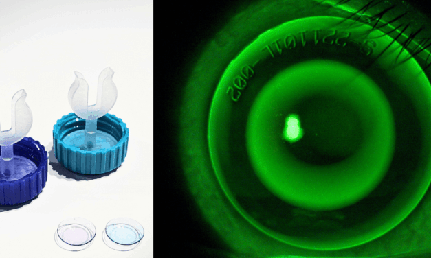 Revolutionary Designed Orthokeratology Lens